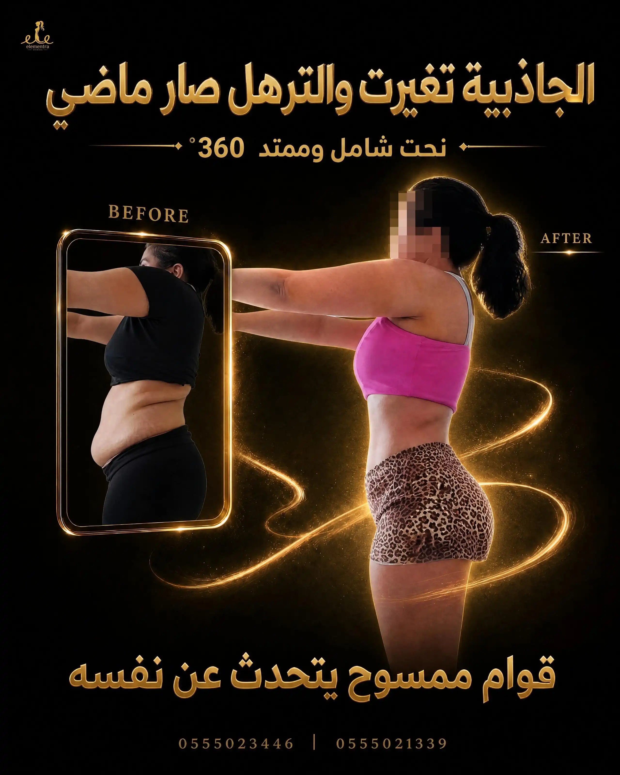 الجاذبية تغيرت والترهل صار ماضي