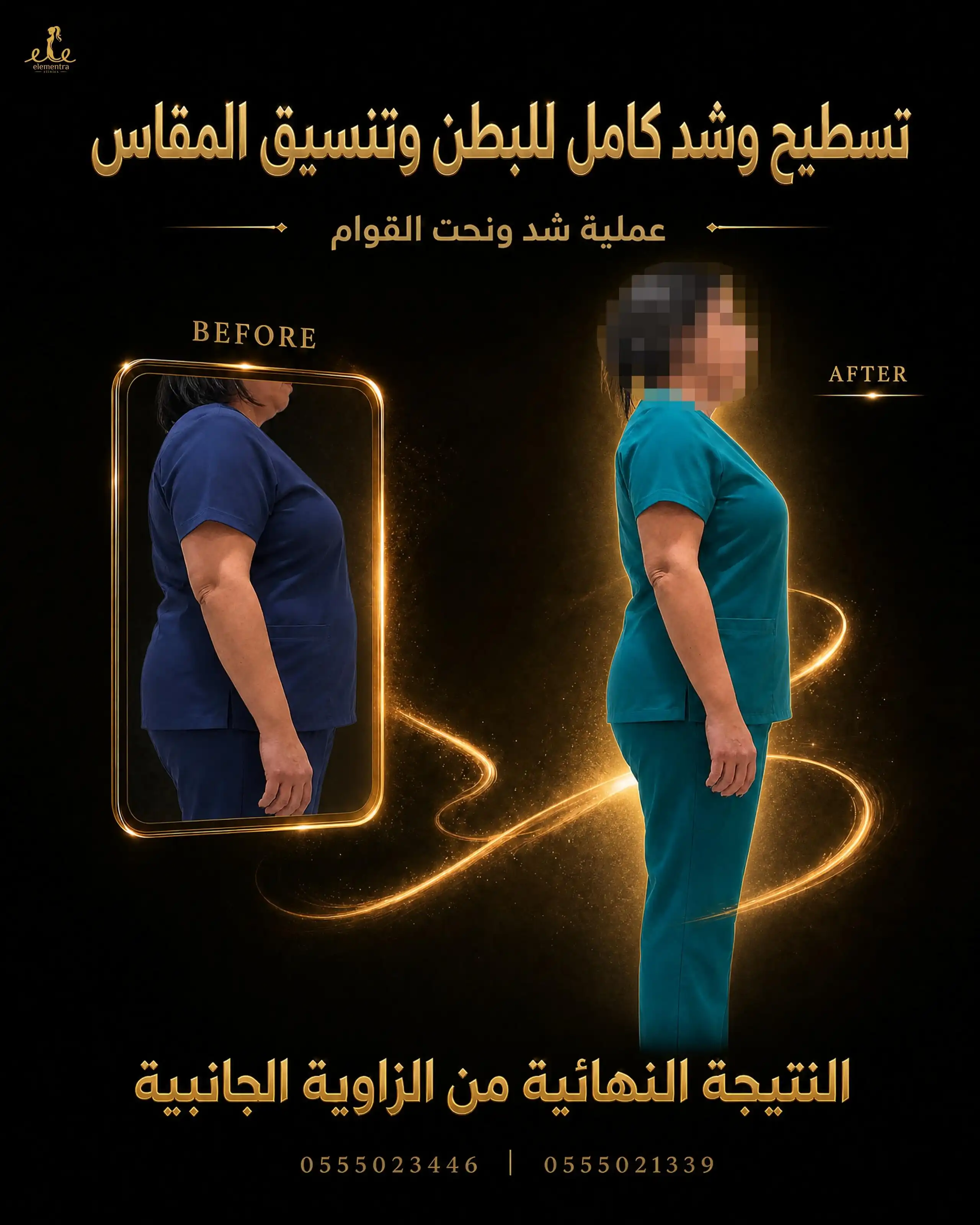 تسطيح وشد كامل للبطن وتنسيق المقاس