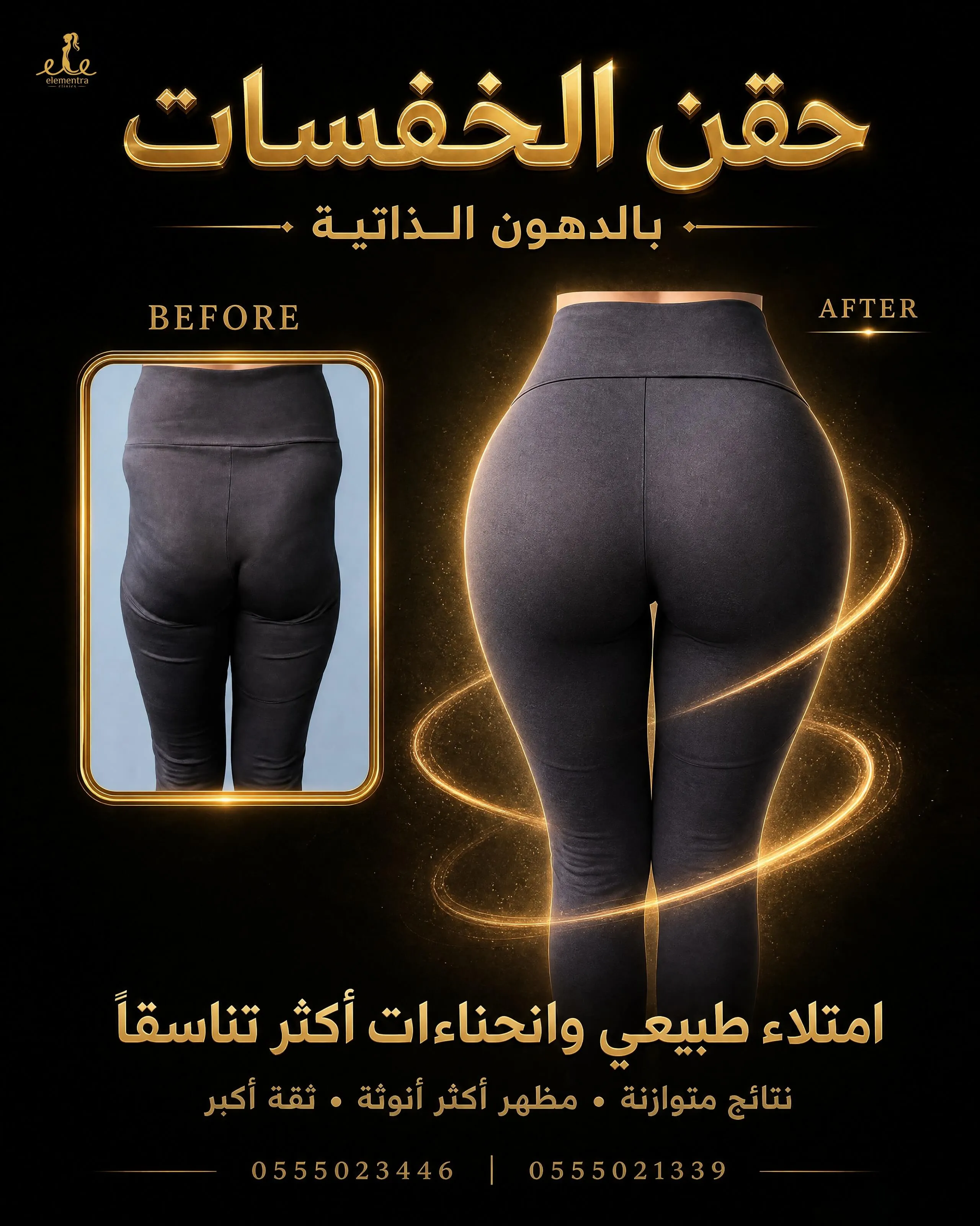 حقن الخفسات