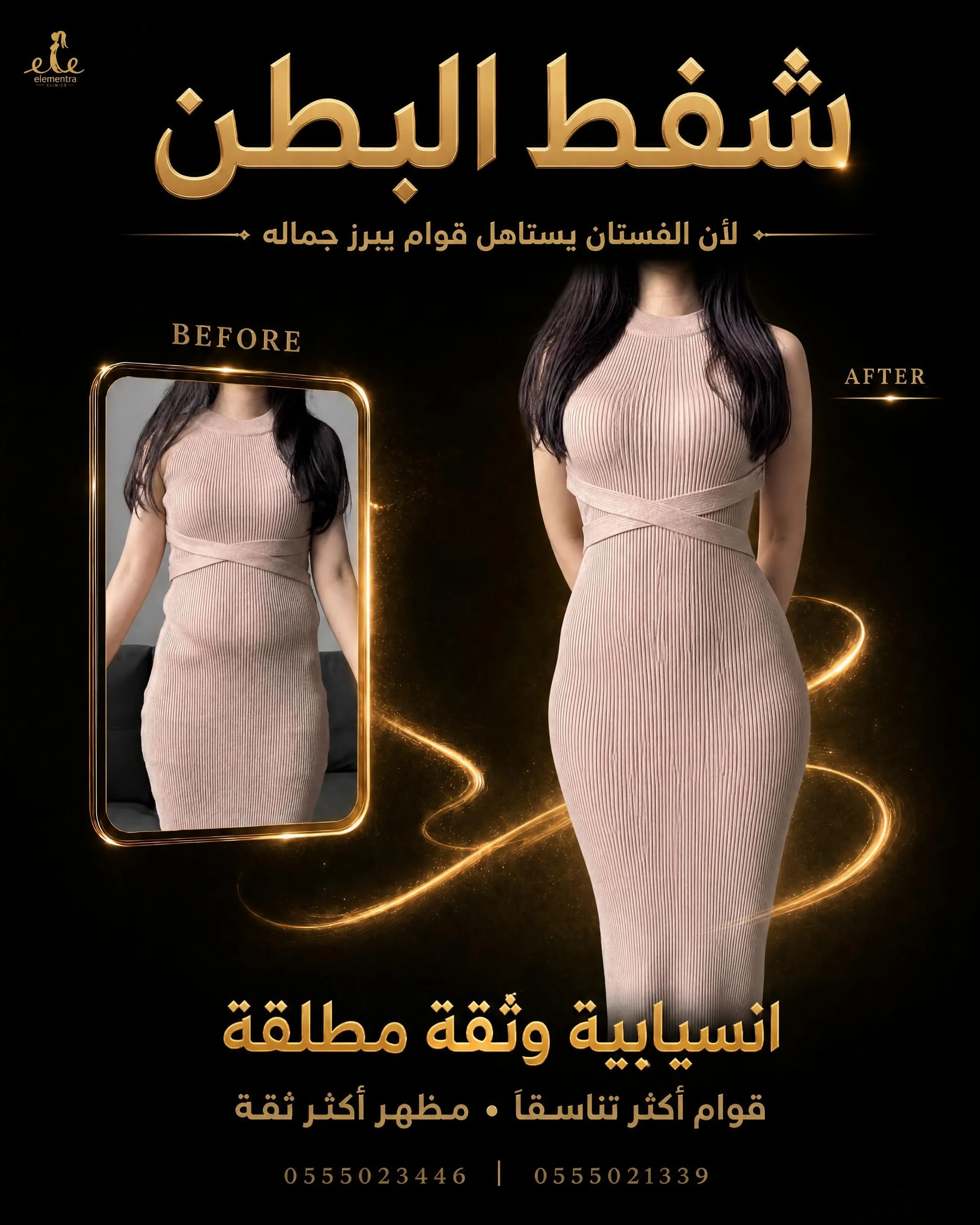 شفط البطن
