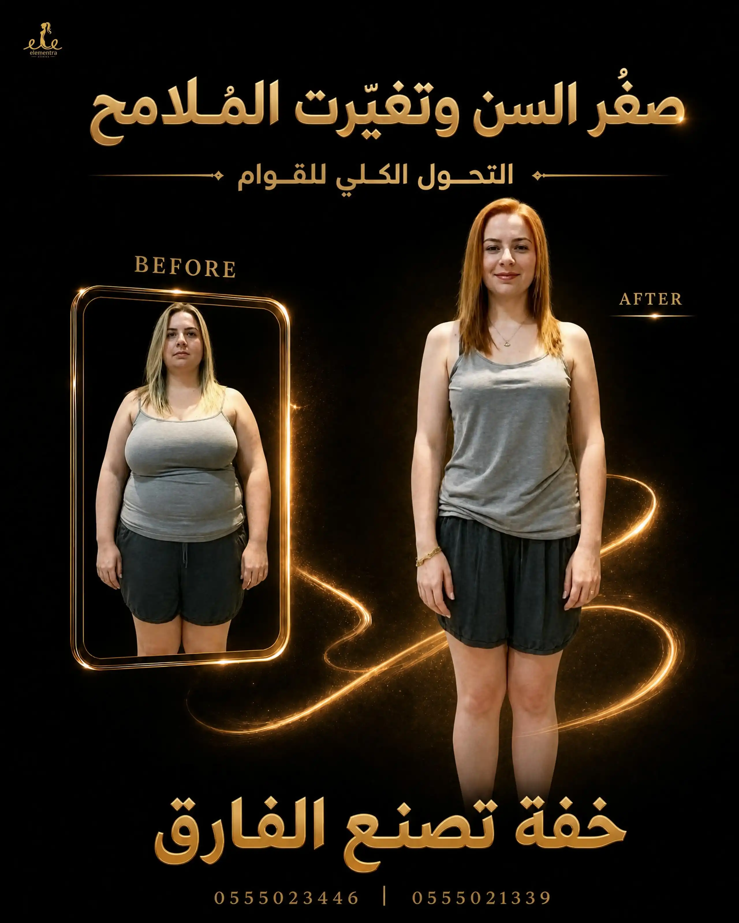 صغر السن وتغيرت الملامح