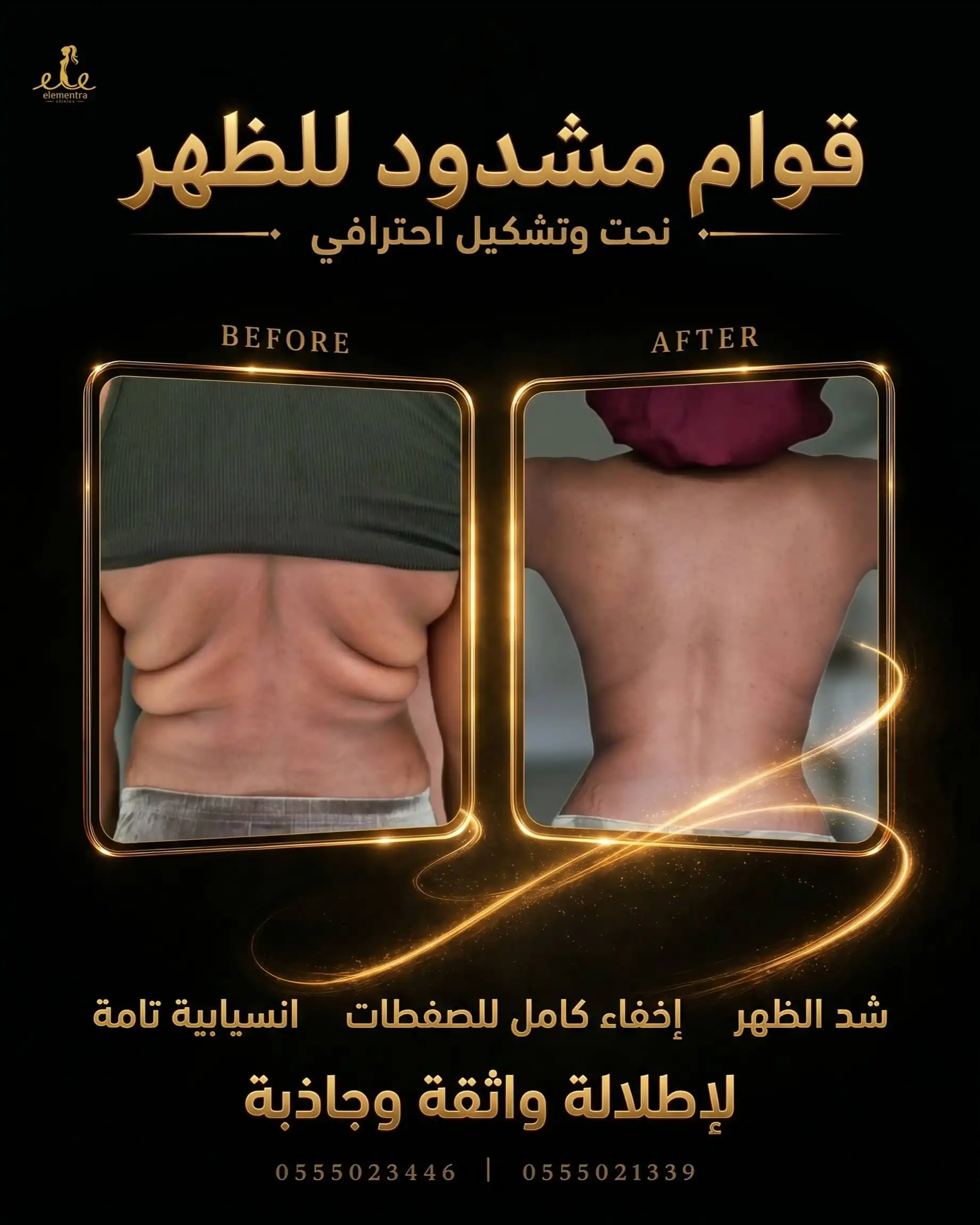 قوام مشدود للظهر