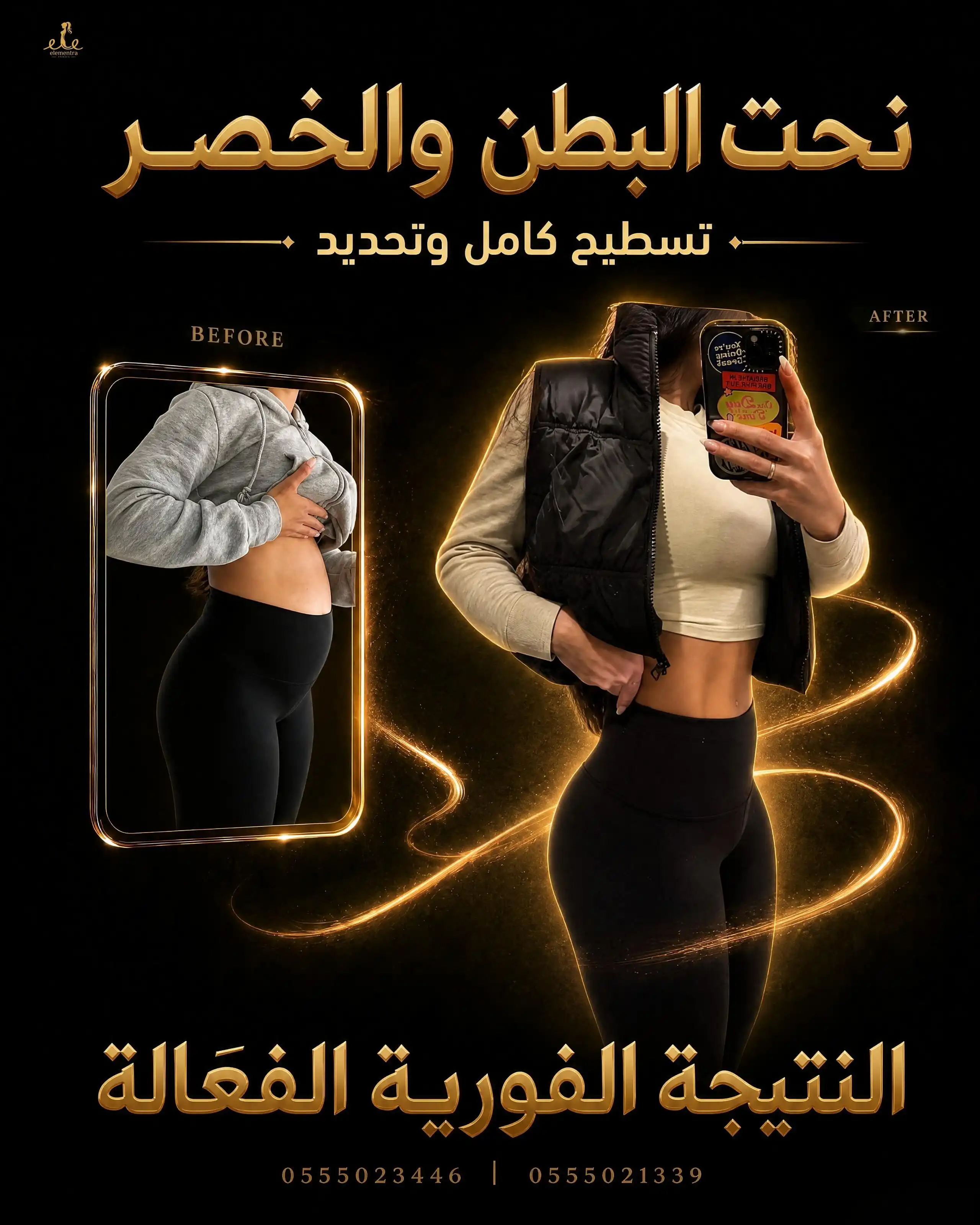 نحت البطن والخصر