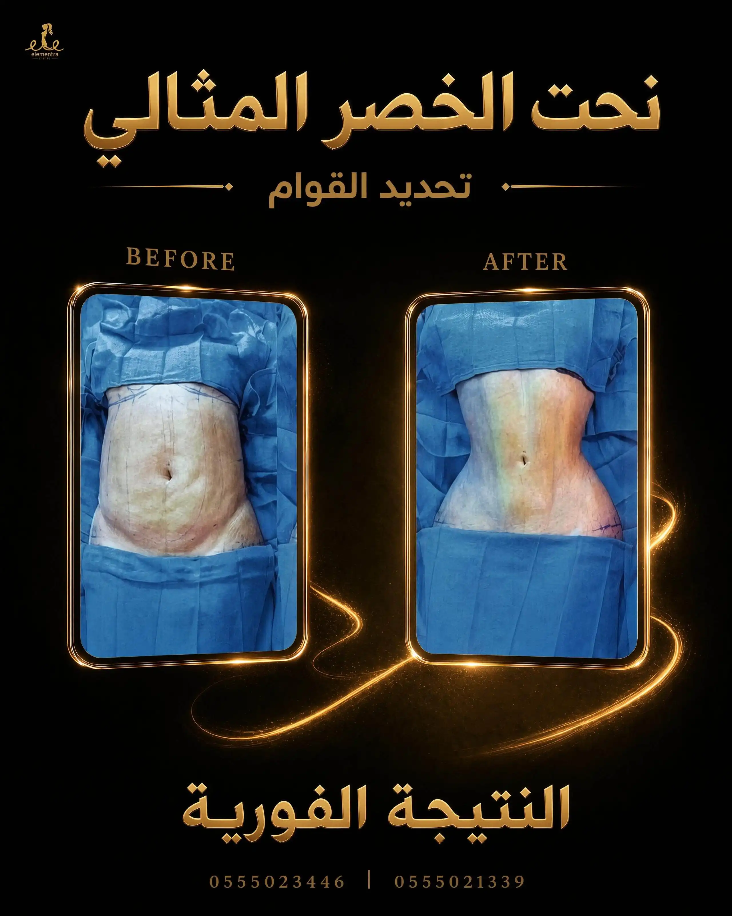 نحت الخصر المثالي