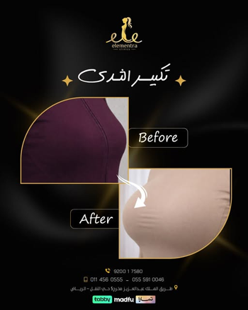 تكبير الثدي ، جراحة التجميل ، جراحة تجميل الجسم